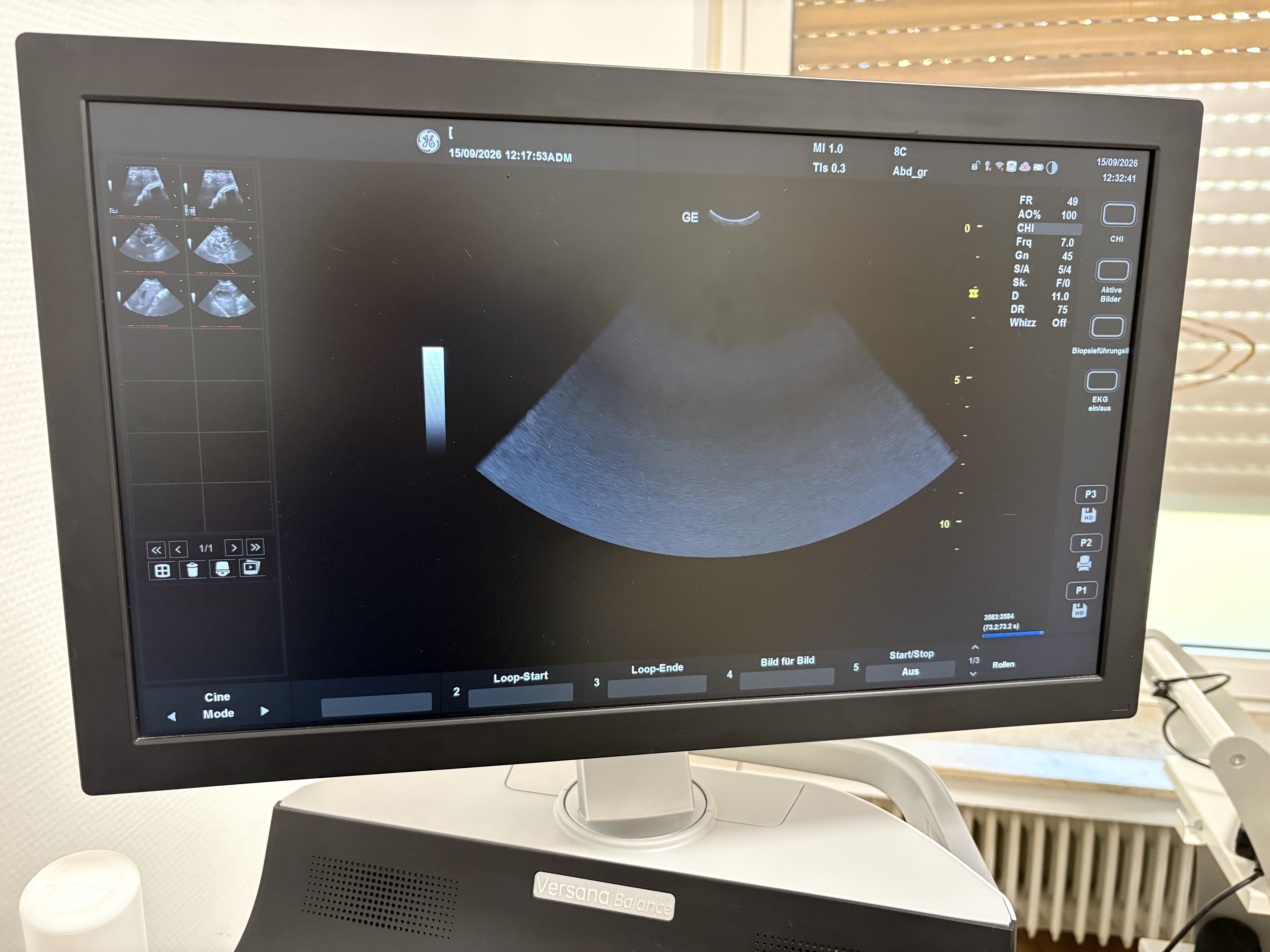 GE Versana Balance VA Veterinär-Ultraschallsystem – Baujahr 2020 inkl. 12L-RS & 8C-RS Sonden